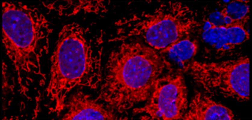 Image of cells from Satish Nadig's research