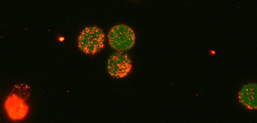 Regulatory T cells