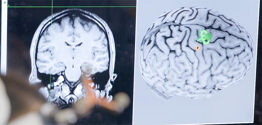 A computer monitor showing brain scans