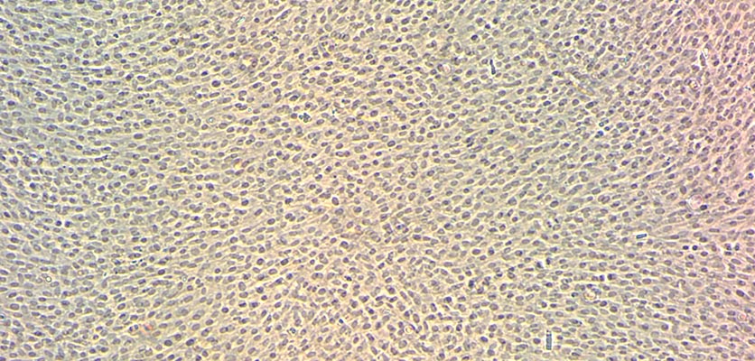 mesenchymal stem cells 